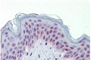 Human Skin (formalin-fixed, paraffin-embedded) stained with NR2C1 antibody ABIN462209 followed by biotinylated goat anti-rabbit IgG secondary antibody ABIN481713, alkaline phosphatase-streptavidin and chromogen. (NR2C1 抗体  (N-Term))