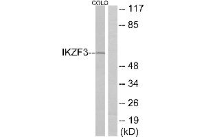 Western blot analysis of extracts from COLO cells, using IKZF3 antibody. (IKZF3 抗体)