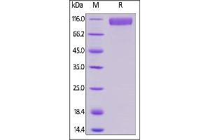 SDS-PAGE (SDS) image for Sialic Acid Binding Ig-Like Lectin 10 (SIGLEC10) (AA 17-546) protein (Fc Tag) (ABIN6253519)