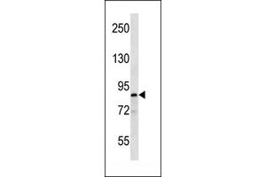 RK Antibody  (ABIN652301 and ABIN2841363) western blot analysis in T47D cell line lysates (35 μg/lane). (MARK1 抗体  (C-Term))