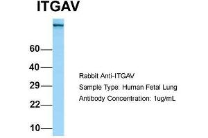 Host: Rabbit  Target Name: ITGAV  Sample Tissue: Human Fetal Lung  Antibody Dilution: 1. (CD51 抗体  (C-Term))