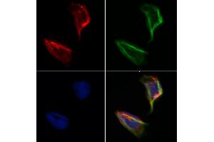 ABIN6264958 and ABIN6273159 staining Hela by IF/ICC. (SEC24A 抗体  (Internal Region))