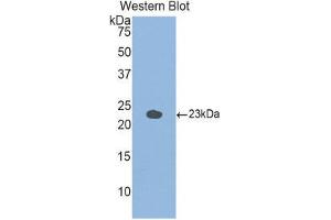 Western Blotting (WB) image for anti-Glucosidase, Alpha, Acid (GAA) (AA 755-953) antibody (ABIN1858938) (GAA 抗体  (AA 755-953))