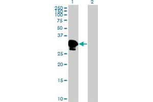 Western Blot analysis of ZNF396 expression in transfected 293T cell line by ZNF396 monoclonal antibody (M01), clone 2F8. (ZNF396 抗体  (AA 131-230))