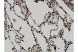 Immunoperoxidase of monoclonal antibody to RBM5 on formalin-fixed paraffin-embedded human lung. (RBM5 抗体  (AA 75-184))