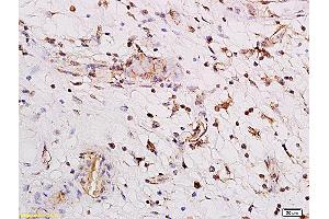 Formalin-fixed and paraffin embedded human enterocolitis labeled with Anti PARG1/Rho GTPase activating protein 29 Polyclonal Antibody, Unconjugated (ABIN762401) followed by conjugation to the secondary antibody and DAB staining (PARG1 抗体  (AA 301-400))