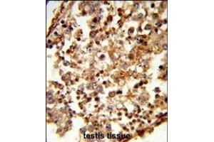 Immunohistochemistry (Paraffin-embedded Sections) (IHC (p)) image for anti-Complement C1q Tumor Necrosis Factor-Related Protein 6 (C1QTNF6) (AA 27-53), (N-Term) antibody (ABIN652830)