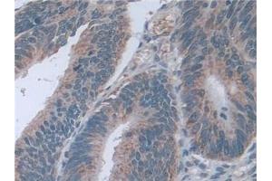 Immunohistochemistry (IHC) image for anti-D-2-Hydroxyglutarate Dehydrogenase (D2HGDH) (AA 56-232) antibody (ABIN7442156)