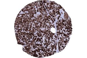 Normal pancreas with strong CELA3B positivity of acinar cells (Recombinant Elastase 3B 抗体  (AA 82-238))