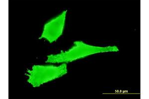 Immunofluorescence of monoclonal antibody to RAB42 on HeLa cell. (RAB42 抗体  (AA 46-105))