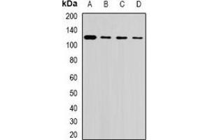 Western blot analysis of USP26 expression in Hela (A), U937 (B), mouse testis (C), rat liver (D) whole cell lysates. (USP26 抗体)