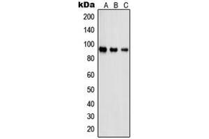 Western blot analysis of PSMD2 expression in Jurkat (A), A431 (B), NIH3T3 (C) whole cell lysates. (PSMD2 抗体  (N-Term))
