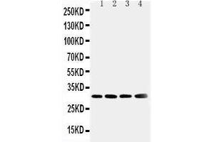 Anti-Superoxide Dismutase 3 antibody, Western blotting Lane 1: Human Placenta Tissue Lysate Lane 2: A549 Cell Lysate Lane 3: MM231 Cell Lysate Lane 4: MCF-7 Cell Lysate (SOD3 抗体  (N-Term))