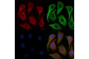 ABIN6257816 and ABIN6275213 staining Hela cells by IF/ICC. (LRP11 抗体  (Internal Region))