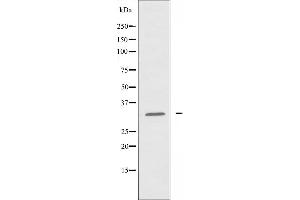 Western blot analysis of extracts from Jurkat cells, using ATF5 antibody. (ATF5 抗体  (N-Term))