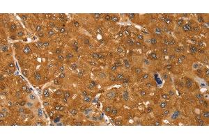 Immunohistochemistry (Paraffin-embedded Sections) (IHC (p)) image for anti-Somatostatin Receptor 3 (SSTR3) antibody (ABIN7242716)