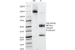 SDS-PAGE (SDS) image for anti-Paired Box 6 (PAX6) (AA 1-300), (N-Term) antibody (ABIN6940257)
