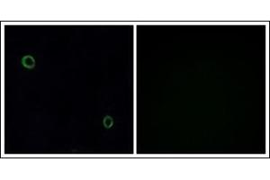 Immunofluorescence analysis of A549 cells, using CXCR4 Antibody. (CXCR4 抗体  (C-Term))