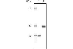 Western blot analysis using SRA mouse mAb against truncated SRA recombinant protein (1) and human ovary cancer tissue lysate (2).