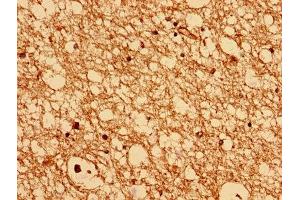 Immunohistochemistry analysis of human brain tissue using ABIN7147533 at dilution of 1:100 (CHMP6 抗体  (AA 2-201))