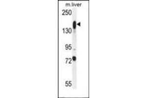 Western blot analysis in mouse liver tissue lysates (35ug/lane) using ASXL1 antibody (Center) Cat. (ASXL1 抗体  (AA 521-549))