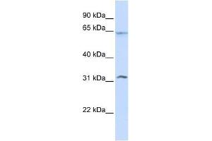 METT10D antibody used at 0.