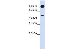 WB Suggested Anti-ADD2 Antibody Titration: 0. (ADD2 抗体  (Middle Region))