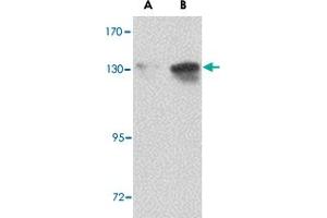 Western blot analysis of NUP155 in P815 cell lysate with NUP155 polyclonal antibody  at (A) 0. (NUP155 抗体  (C-Term))