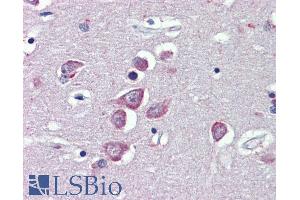 Immunohistochemistry (IHC) image for anti-Transient Receptor Potential Cation Channel, Subfamily M, Member 2 (TRPM2) (Internal Region) antibody (ABIN6391352)