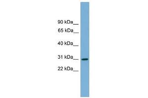 HLA-DQA2 antibody used at 1 ug/ml to detect target protein. (HLA-DQA2 抗体  (Middle Region))