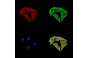 ABIN7095950 and ABIN7100012 staining Hela cells by IF/ICC. (SCYL3 抗体)