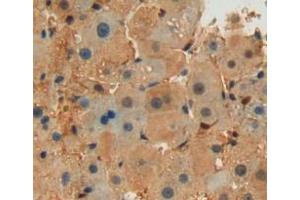Used in DAB staining on fromalin fixed paraffin-embedded liver tissue (Septin 6 抗体  (AA 87-327))