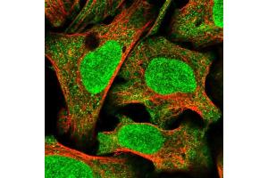 Immunofluorescent staining of human cell line U-2 OS shows localization to nucleus & cytosol.