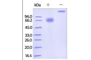 Human IFN-gamma R1, Fc Tag on SDS-PAGE under reducing (R) condition. (IFNGR1 Protein (AA 18-245) (Fc Tag))
