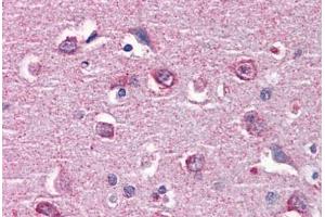 Human Brain, cortex: Formalin-Fixed, Paraffin-Embedded (FFPE) (CAMK2B 抗体  (AA 1-504))