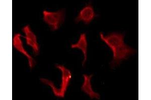 ABIN6276128 staining HeLa by IF/ICC. (OR2B2 抗体  (Internal Region))