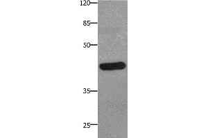 Western Blotting (WB) image for anti-Prostaglandin E Receptor 2 (Subtype EP2), 53kDa (PTGER2) antibody (ABIN2425819) (PTGER2 抗体)
