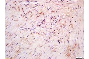 Formalin-fixed and paraffin embedded human myometrium labeled with Anti phospho-ERK5(Ser731+Thr733) Polyclonal Antibody, Unconjugated (ABIN710276) at 1:200 followed by conjugation to the secondary antibody and DAB staining (MAPK7 抗体  (pSer731, pThr733))