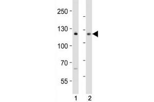 Western blot analysis of lysate from (1) MCF-7 and (2) Jurkat cell line using NOTCH antibody at 1:1000.