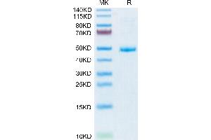 Human CD42a/GP9 on Tris-Bis PAGE under reduced condition. (CD42a Protein (AA 17-147) (Fc Tag))