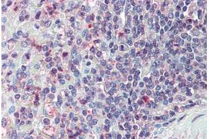 Anti-CD70 antibody  ABIN960751 IHC staining of human spleen. (CD70 抗体  (N-Term))