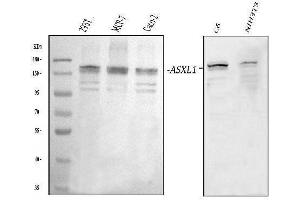 Western blot analysis of ASXL1 using anti-ASXL1 antibody (ABIN5693162).