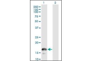 Western Blotting (WB) image for anti-CD247 Molecule (CD247) (AA 1-165) antibody (ABIN782349) (CD247 抗体  (AA 1-165))