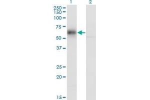 Western Blot analysis of GDI1 expression in transfected 293T cell line by GDI1 monoclonal antibody (M08), clone 1H3. (GDI1 抗体  (AA 1-447))
