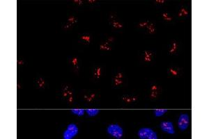 Confocal immunofluorescence analysis of U2OS cells using KRR1 Polyclonal Antibody at dilution of 1:100. (KRR1 抗体)