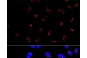 Confocal immunofluorescence analysis of U2OS cells using KRR1 Polyclonal Antibody at dilution of 1:100. (KRR1 抗体)