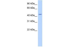 WB Suggested Anti-TRNT1 Antibody Titration:  2. (Trnt1 抗体  (N-Term))