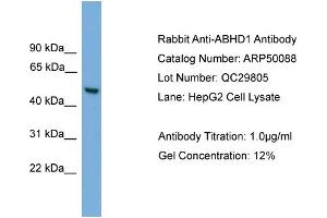 WB Suggested Anti-ABHD1  Antibody Titration: 0.