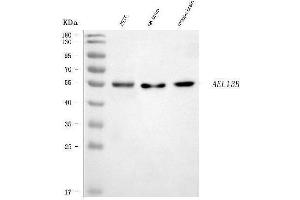 Western blot analysis of ARL13B using anti-ARL13B antibody (ABIN7600179).