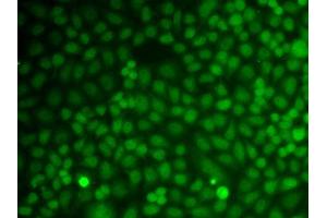 Immunofluorescence analysis of A549 cell using GADD45A antibody.